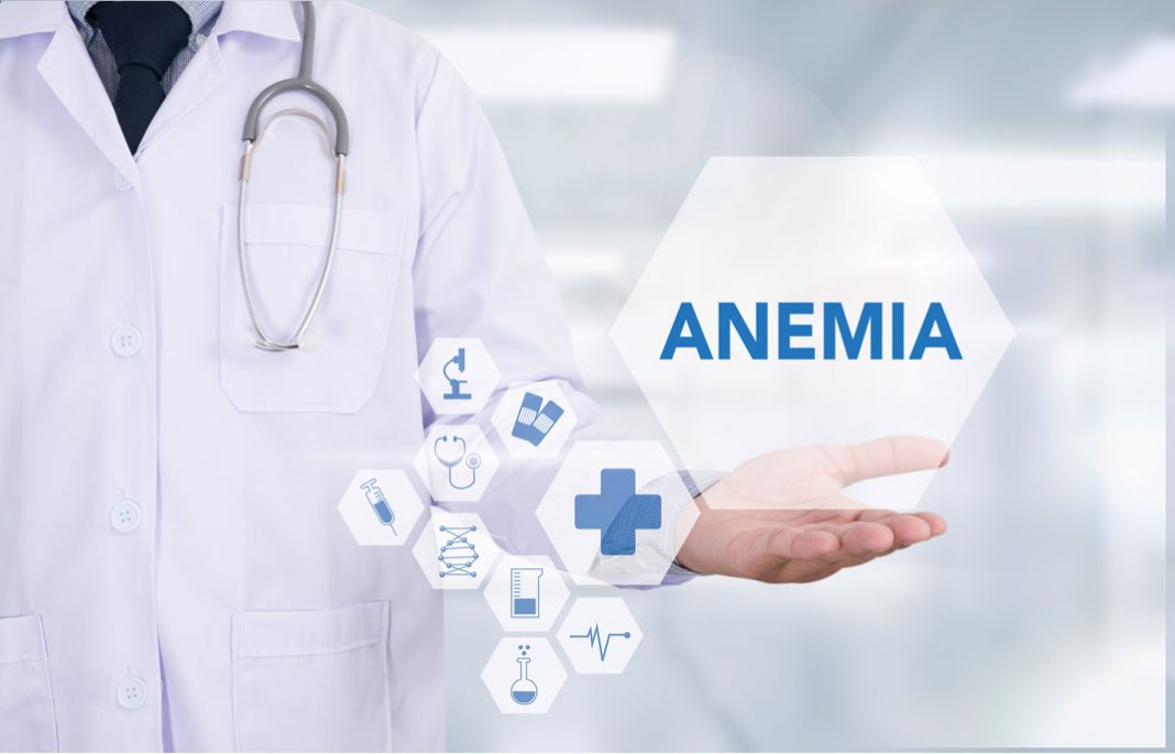 Anemia