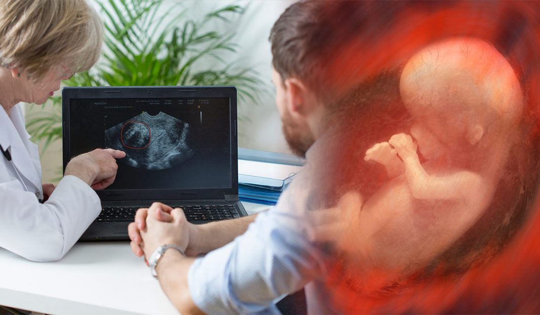 Angelmanov sindrom resitev