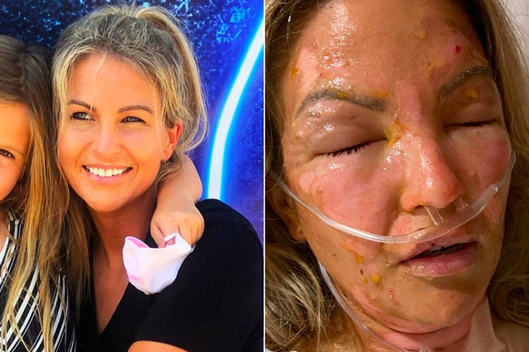 Razkužilo za roke požar