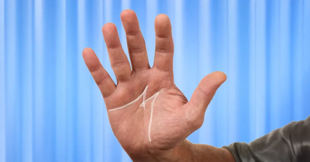 Kaj pomeni če imate na dlani črto v obliki črke M