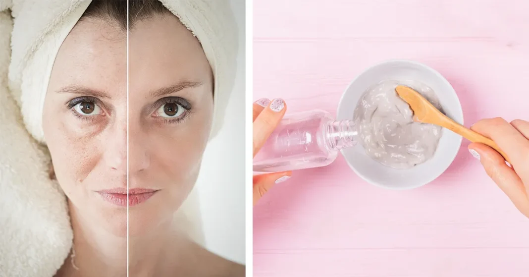 Recept s sodo bikarbono, ki odstrani madeže, gubice in podočnjake