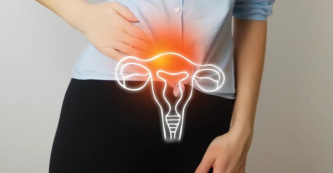 Cistitis ali vnetje sečnika Kako si lahko sami pomagamo